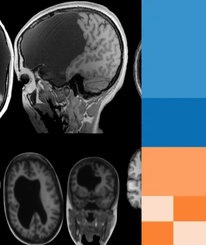 Brain Hackers Highlight 3 Brain Hackers Highlight 3