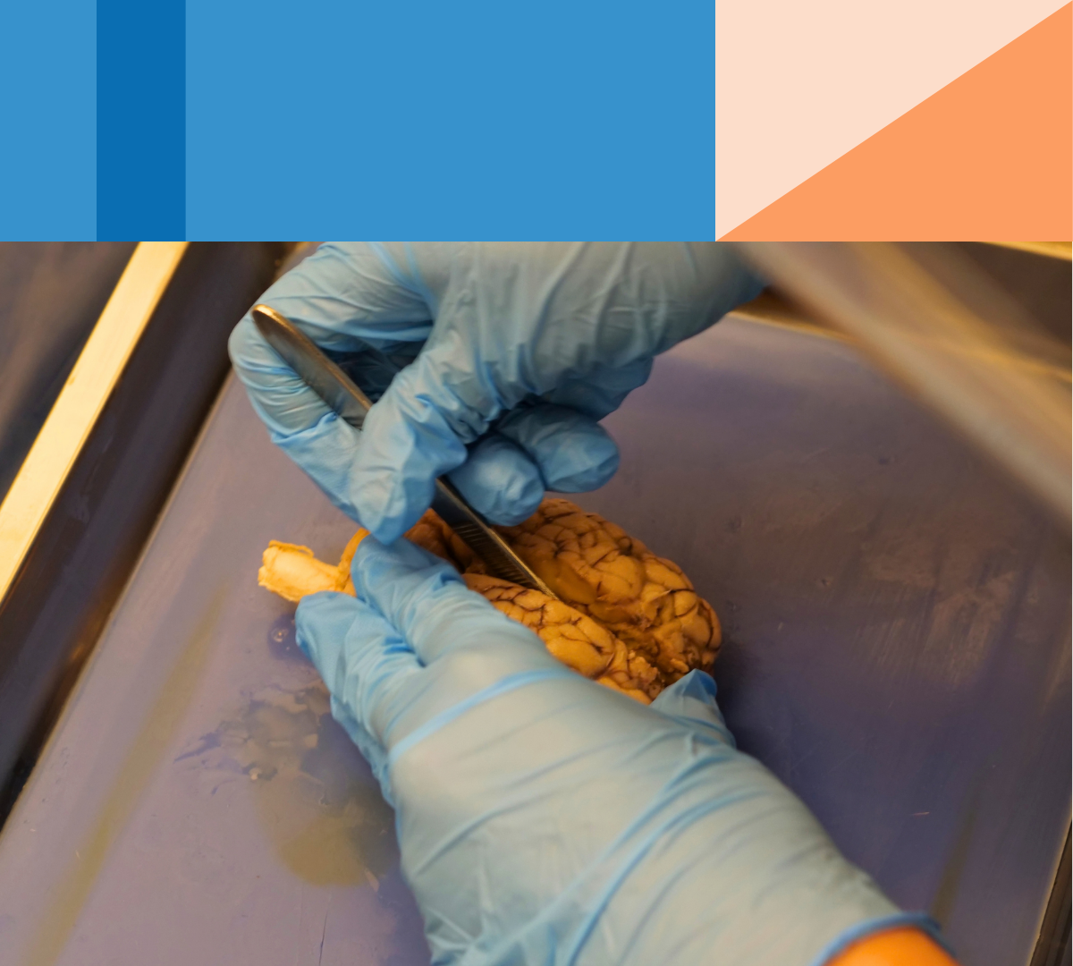 Sheep Brain Dissection